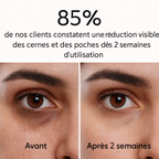 Elyskin - Soin contour des yeux 3-en-1 avec embout massant lumière rouge
